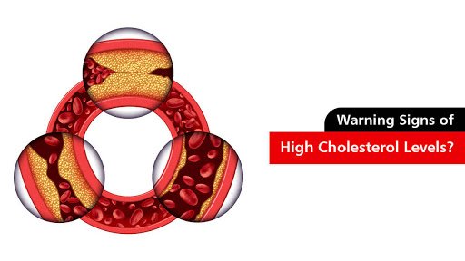warning signs of high cholesterol levels